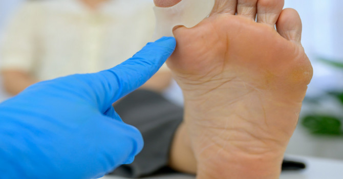 Bunion Pain: Understanding Causes, Symptoms, and Effective Treatments image